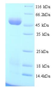 Acinetobacter baumannii EFTU / TUFM Protein (Recombinant His)