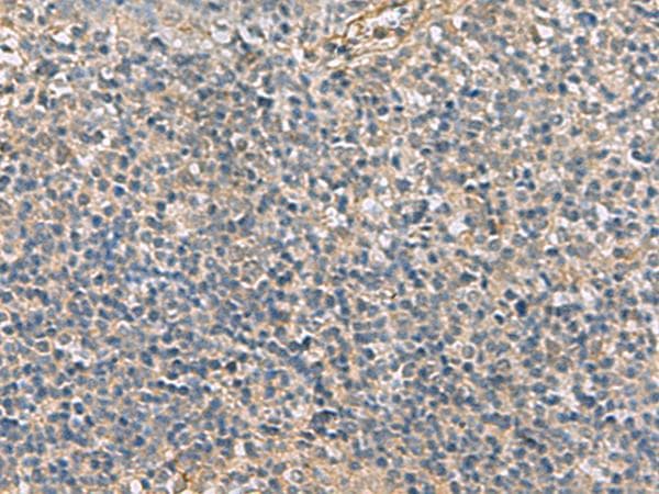 Polyclonal Rabbit anti-Human APOBR / APOB48R Antibody (IHC)
