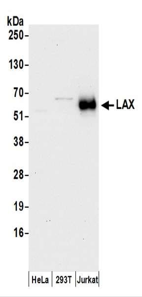 LAX1 / LAX Antibody (aa348-398)