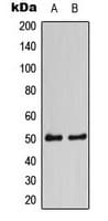 CaMKII Alpha+Delta Antibody (Internal)