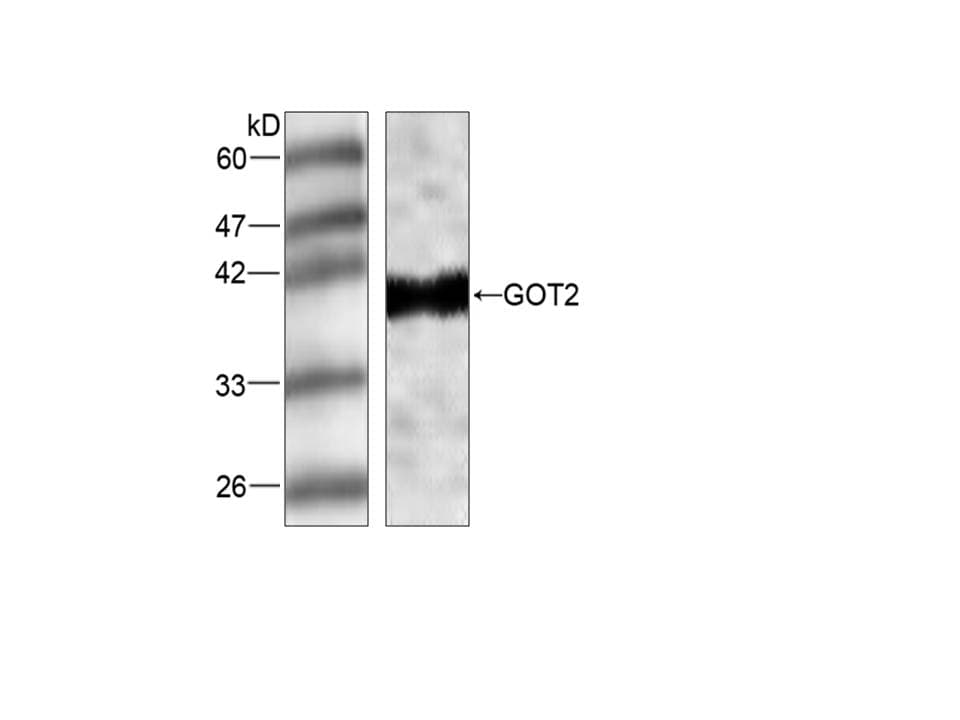 GOT2 Antibody (aa25-430)