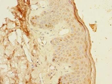 Polyclonal Rabbit anti-Human PCIF1 Antibody (IHC)