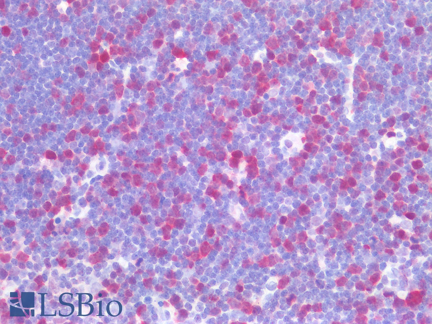 IHC-plus™ TS / Thymidylate Synthase Antibody (clone OTI2C3)