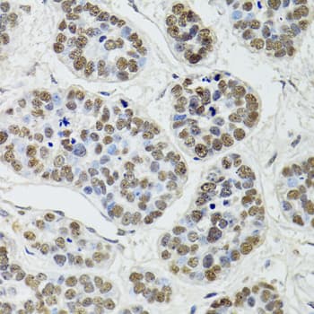 CDX2 Antibody