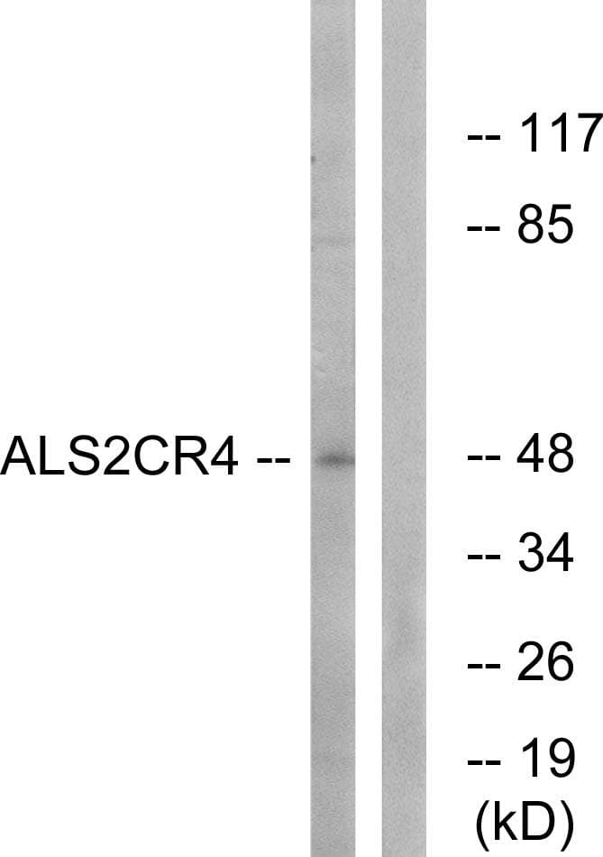 TMEM237 / ALS2CR4 Antibody