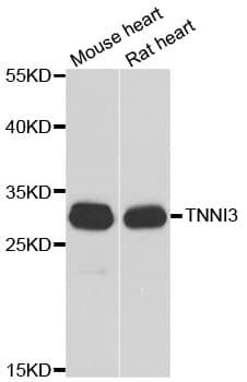 TNNI3 / Cardiac Troponin I Antibody