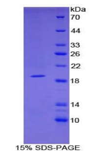 Mouse FABP9 / Lipid-Binding Protein (Recombinant His, N-Terminal)