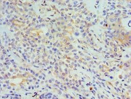Polyclonal Rabbit anti-Human TNFSF13 / APRIL Antibody (aa105-247, IHC, WB)
