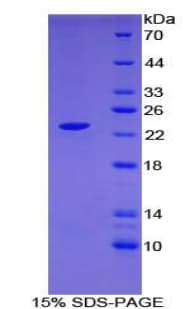 Human CLEC10A / CD301 Protein (Recombinant His-T7)