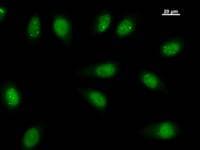 TEAD2 Antibody (clone 404C5a)
