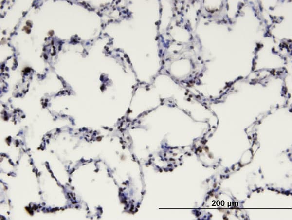 MBD1 Antibody (clone 2C7)