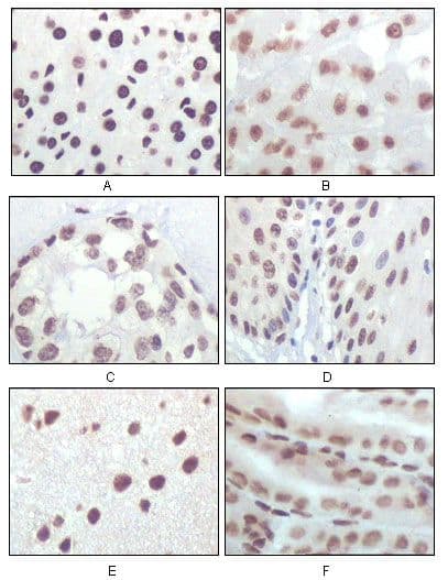 Monoclonal Mouse anti-Rat p16INK4a / CDKN2A Antibody (clone 1E12E10, IHC, WB)