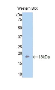 ITGAM / CD11b Antibody (aa808-931)