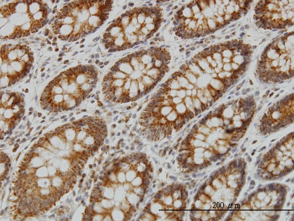 Monoclonal Mouse anti-Human NDUFS4 Antibody (clone 1A1, IHC, WB)