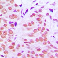 JUN / c-Jun Antibody (phospho-Thr91)