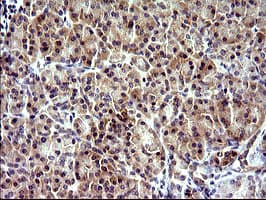 Monoclonal Mouse anti-Human CHAC1 / MGC4504 Antibody (clone OTI1E2, Carrier-free, IHC, IF, WB)