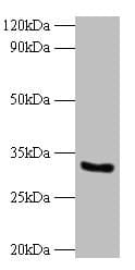IHC-plus™ CYB5R3 / B5R Antibody