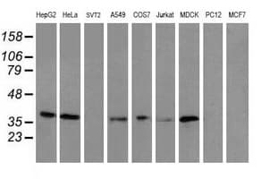 UBXN2B Antibody (clone OTI2E8)
