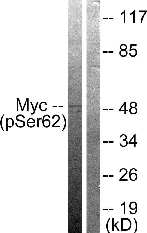 MYC / c-Myc Antibody (phospho-Ser62)