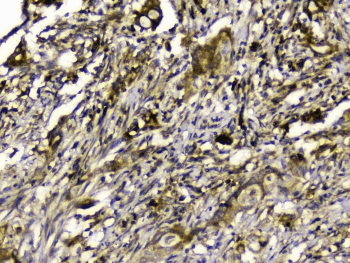 Polyclonal Rabbit anti-Human SIRT4 / Sirtuin 4 Antibody (IHC, WB)