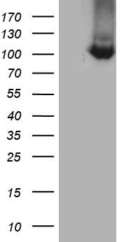 Monoclonal Mouse anti-Human TTC7A Antibody (clone OTI2D3, aa1-450, WB)