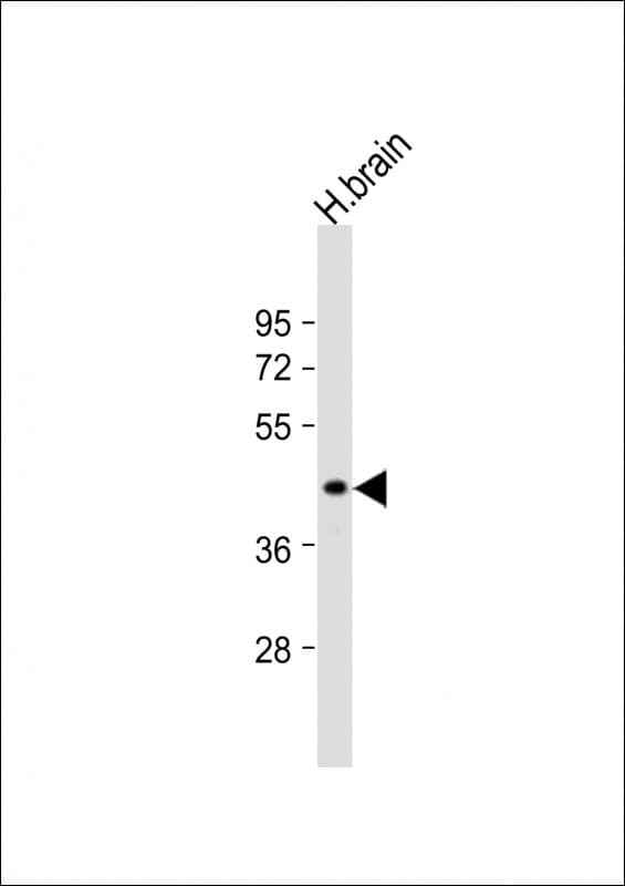 ER81 / ETV1 Antibody (aa32-65)