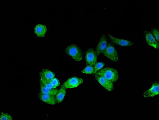 PTCH1 / Patched 1 Antibody