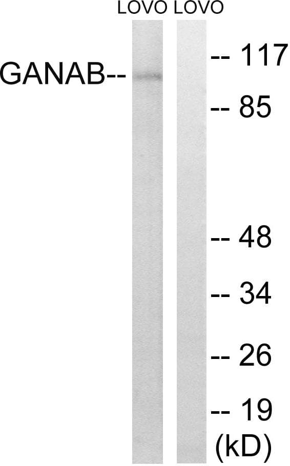 GANAB / Alpha Glucosidase II Antibody
