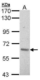 Polyclonal Rabbit anti-Human ARAF / ARAF1 / A-RAF Antibody (aa371-554, IHC, WB)