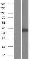 LIMS2 Protein (Over-Expression Lysate Myc-DDK (Flag))