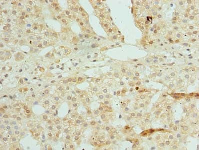 ZNF193 Antibody