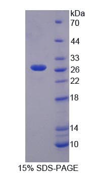 Rat TSH Receptor / TSHR Protein (Recombinant 6His, N-terminus)