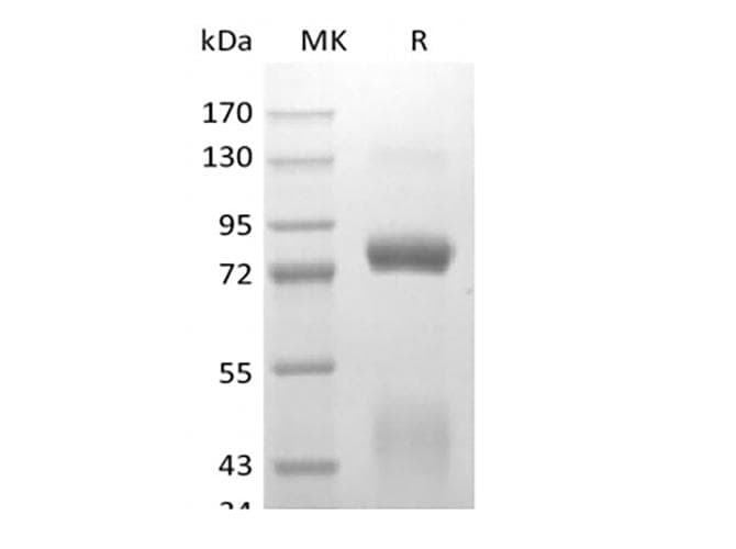 Hepatocyte Growth Factor [human, Fibroblasts Partial, 19 Nt] Protein (Recombinant AVI-6His, C-terminus)