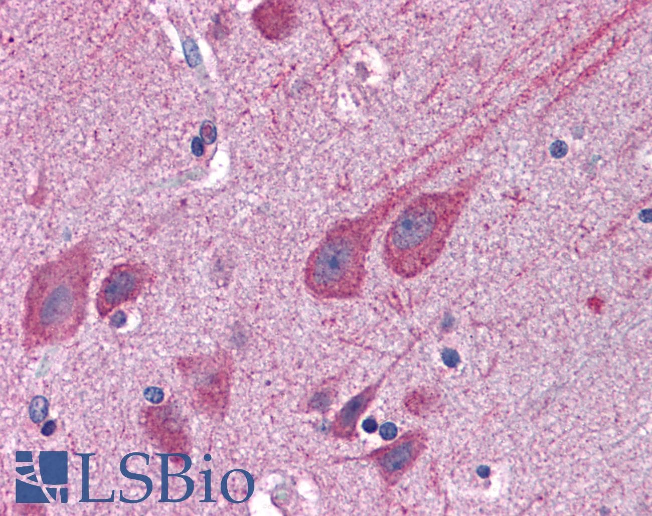 IHC-plus™ STAP2 Antibody (aa436-449)