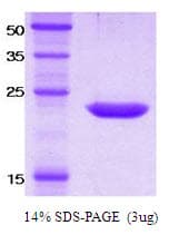 Human KIR2DS4 Protein (Recombinant)