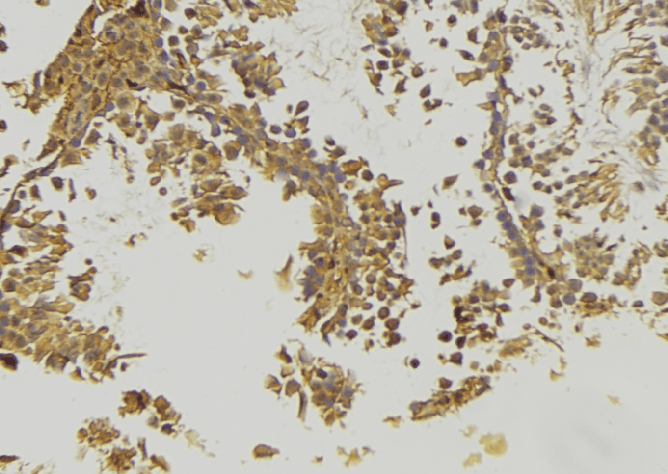 PDHA2 / PDH E1 Beta Antibody