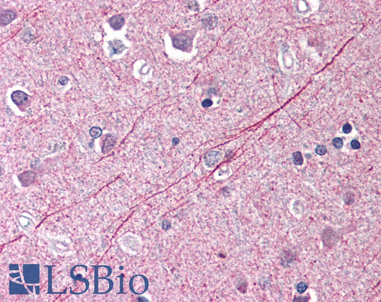 Polyclonal Rabbit anti-Human PHAP III / ANP32E Antibody (IHC, IF, WB)