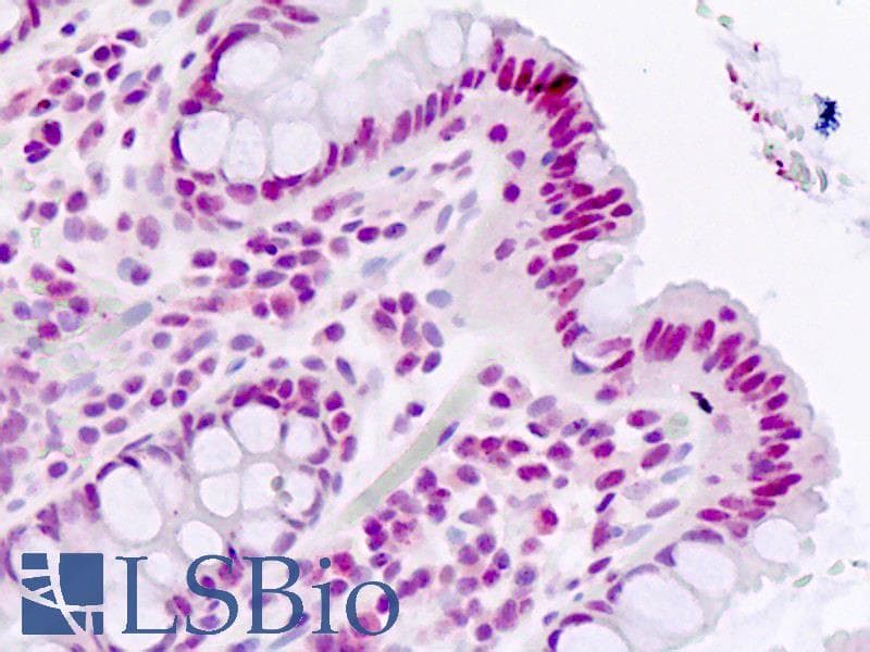 IHC-plus™ Polyclonal Rabbit anti-Human AP-1 / JUND Antibody (Ser255, IHC, WB)