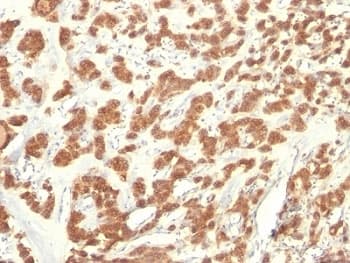 KRT18 / CK18 / Cytokeratin 18 Antibody (clone KRT18/835)