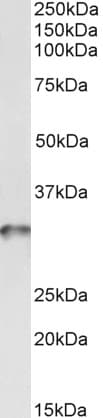 IHC-plus™ TPM4 Antibody (aa266-276)