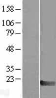 MAX Protein (Over-Expression Lysate Myc-DDK (Flag))