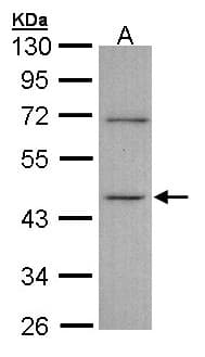 Polyclonal Rabbit anti-Human ITPK1 Antibody (aa171-414, WB)