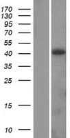ADH4 Protein (Over-Expression Lysate Myc-DDK (Flag))