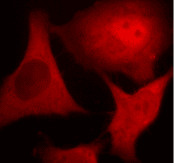 UBC / Ubiquitin C Antibody