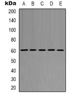 AKT1 Antibody (Internal)