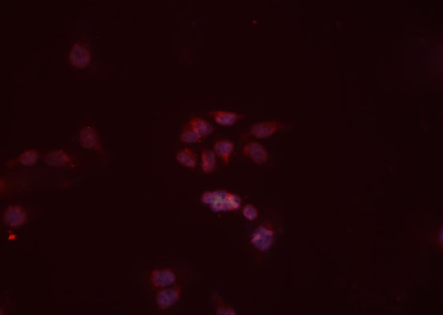 MURF1 / IRF Antibody