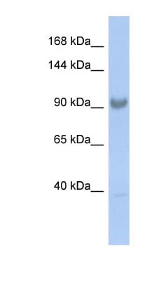 SART3 Antibody (aa827-876)