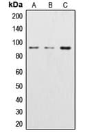 CTNNB1 / Beta Catenin Antibody (N-Terminus)