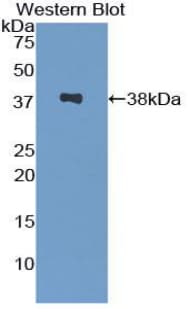 SPINK1 Antibody (aa26-78)