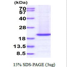 Human RHEB Protein (Recombinant)